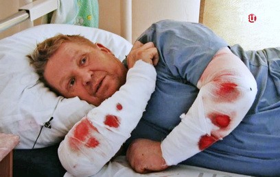 В Челябинской области ротвейлеры растерзали двух мужчин
