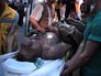 Пострадавший при взрыве на шахте в Турции Пострадавший при взрыве на шахте в Турции