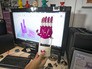 Напечатанный 3D-протез Напечатанный 3D-протез