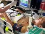 Эвакуация пострадавших при обрушении здания казарм учебного центра ВДВ в Омске Эвакуация пострадавших при обрушении здания казарм учебного центра ВДВ в Омске