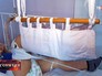 Ребенок с переломом ноги Ребенок с переломом ноги