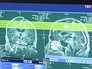 Результат томограммы головного мозга Результат томограммы головного мозга