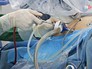Хирургическая операция Хирургическая операция