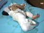 Пострадавший ребенок Пострадавший ребенок