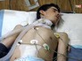Пострадавшие от действия химического оружия в Сирии Пострадавшие от действия химического оружия в Сирии