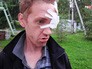 Пострадавший от действий стрелка в Иркутской области Пострадавший от действий стрелка в Иркутской области