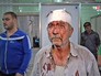 Пострадавшие при обстреле жилых кварталов в Сирии Пострадавшие при обстреле жилых кварталов в Сирии