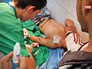 Пострадавшие при обстреле жилых кварталов в Сирии Пострадавшие при обстреле жилых кварталов в Сирии