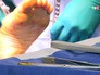 Хирурги проводят операцию на ноге Хирурги проводят операцию на ноге