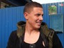 Пострадавший от нападения медведя Пострадавший от нападения медведя