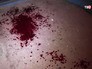 Последствия обстрела жилых районов Донбасса Последствия обстрела жилых районов Донбасса