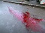 Последствия стрельбы во время беспорядков на Майдане в 2014 году Последствия стрельбы во время беспорядков на Майдане в 2014 году