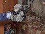 3D-рука протез для девочки 3D-рука протез для девочки