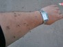 Нашествие комаров в Воронежской области Нашествие комаров в Воронежской области