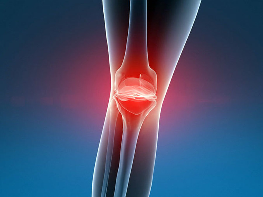 Заболевания суставов конечностей. Эпикондилит коленного сустава. Боль в суставах. Суставные боли.