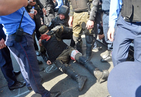 Сотрудник правоохранительных органов, пострадавший во время столкновений с участниками митинга у здания Верховной Рады Украины