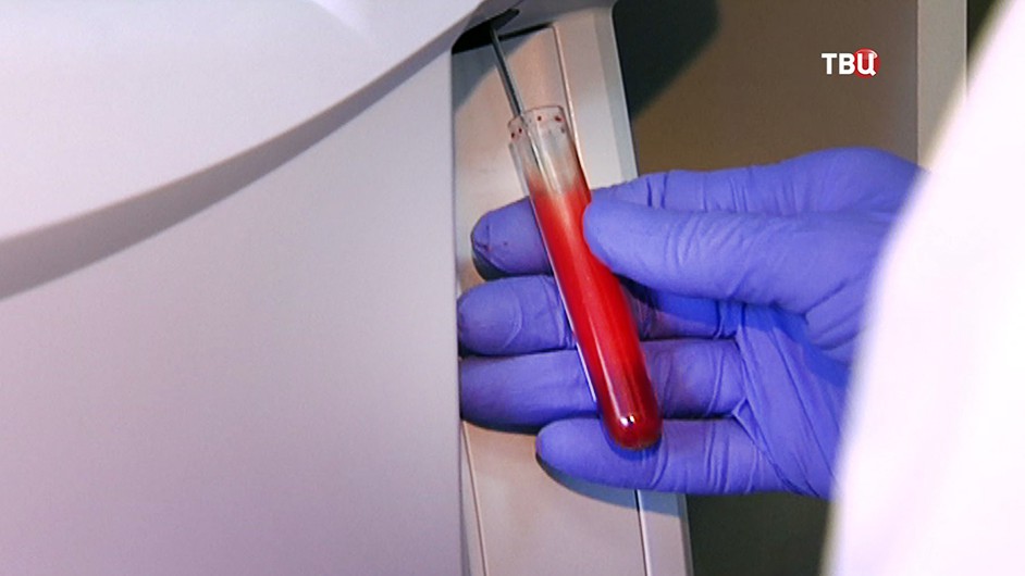 Анализы крови в лаборатории