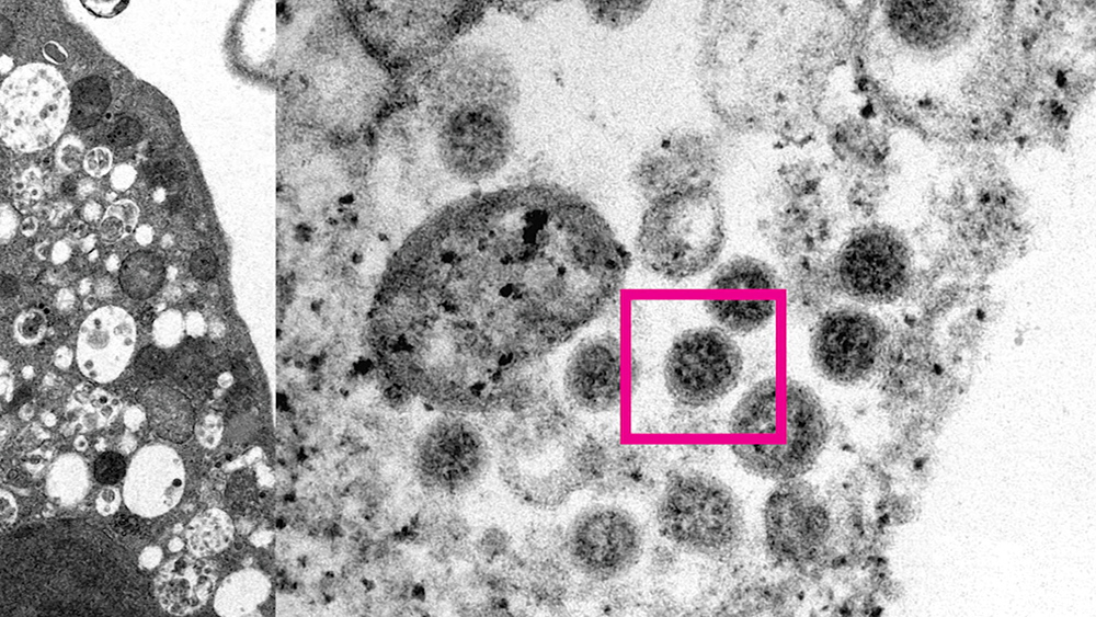 Снимок омикрон-штамма коронавируса